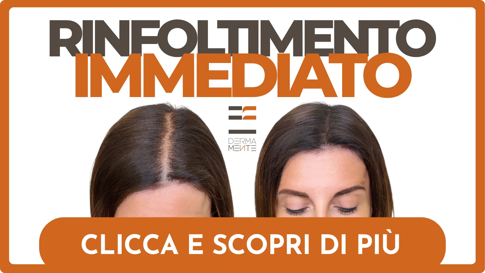 Rinfoltimento Immediato